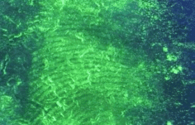 Fingerprint Recovery from Challenging Surfaces